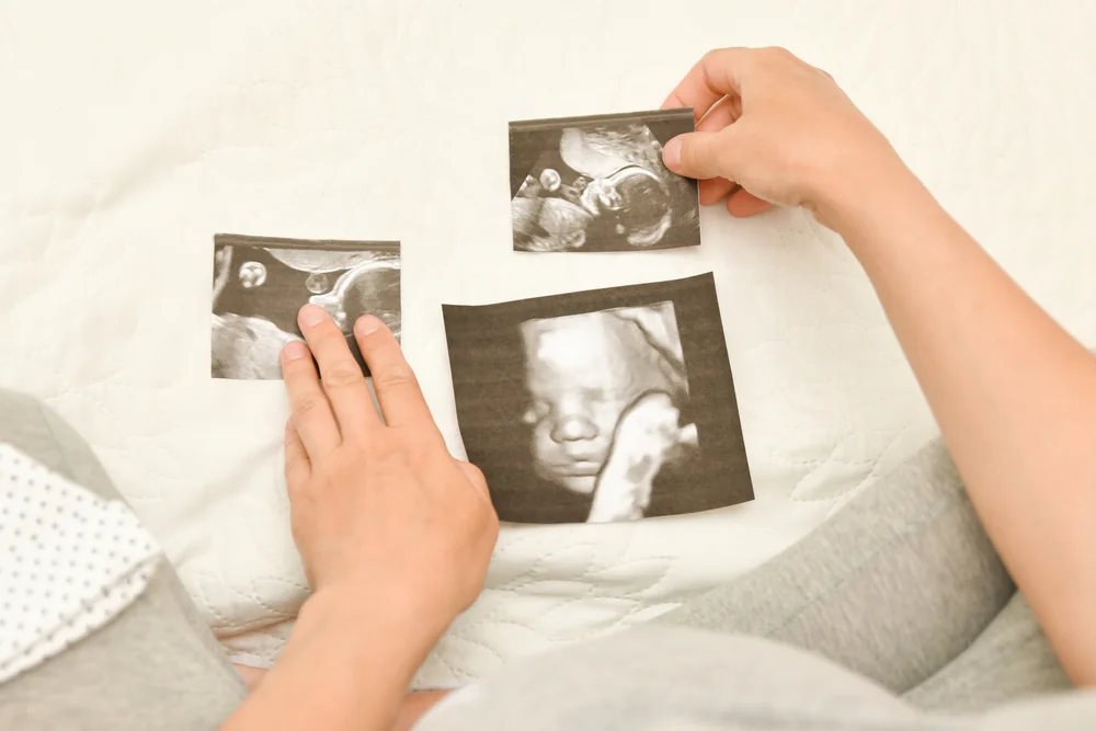 How to Take Great 3D4D Ultrasound Photos